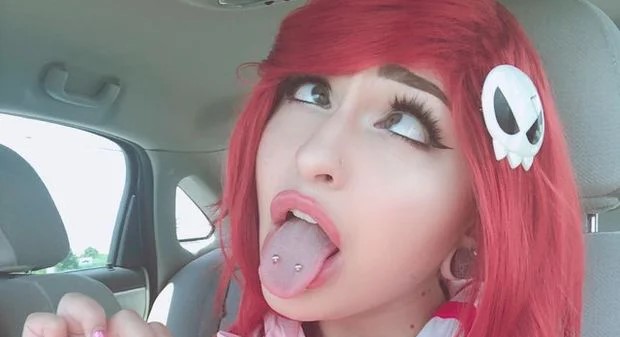 20278930